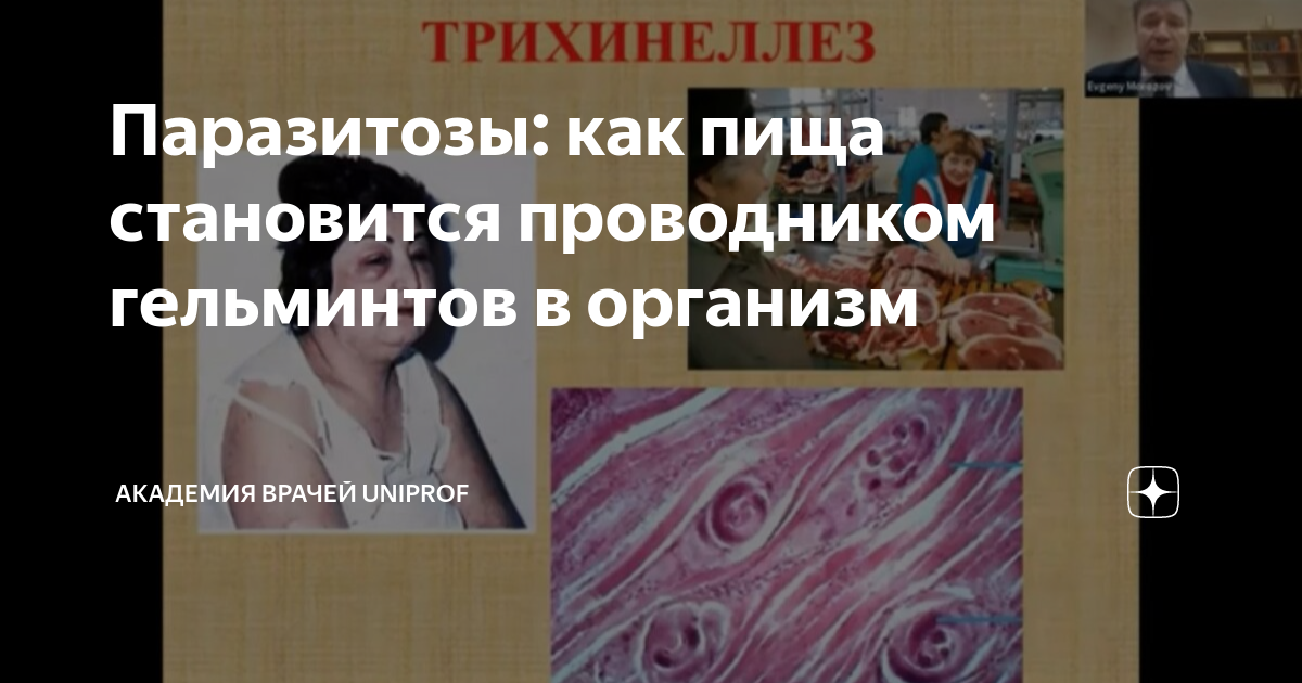Паразитозы: как пища становится проводником гельминтов в организм ...