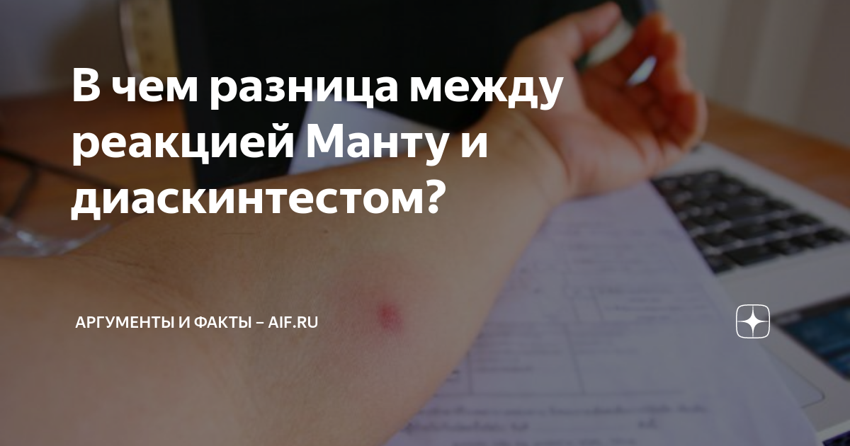 Где можно сделать диаскинтест ребенку. Разница между манту и Диаскинтестом. Манту и диаскинтест разница. Реакция манту и диаскинтест.