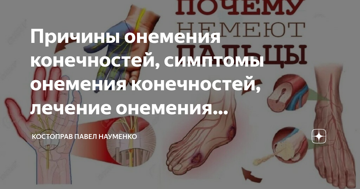 Немеют колени причины у мужчин. Онемение пальцев стопы. Препарат от онемения конечностей. Почему немеют конечности.