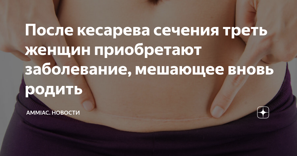 После кесарева сечения треть женщин приобретают заболевание, мешающее ...