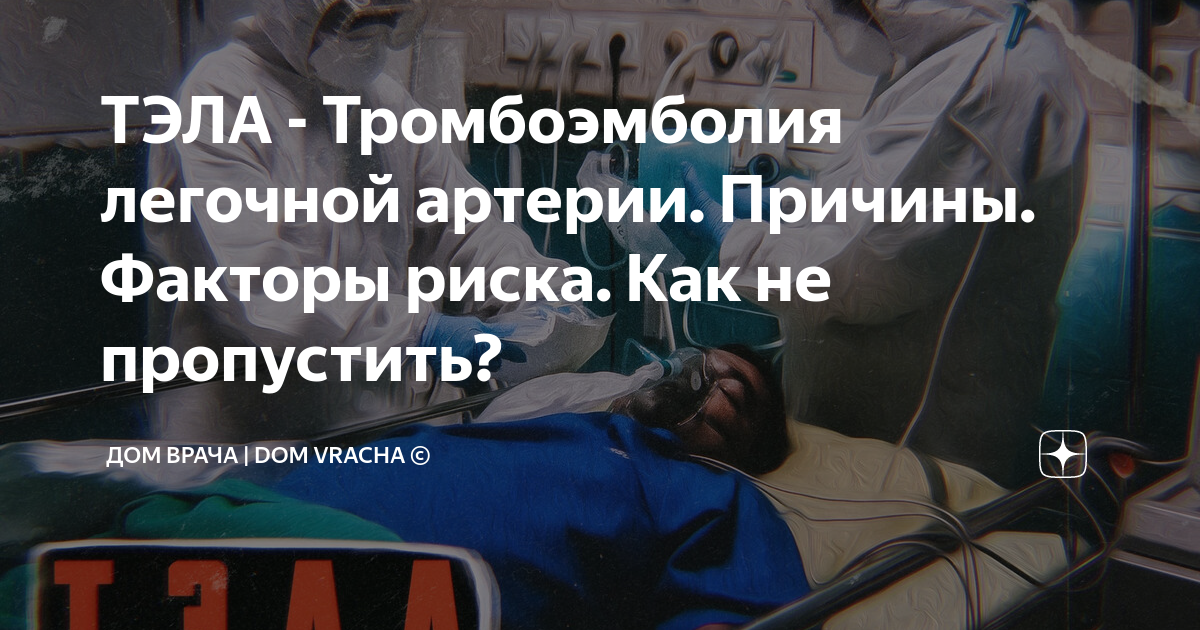 ТЭЛА - Тромбоэмболия легочной артерии. Причины. Факторы риска. Как не ...