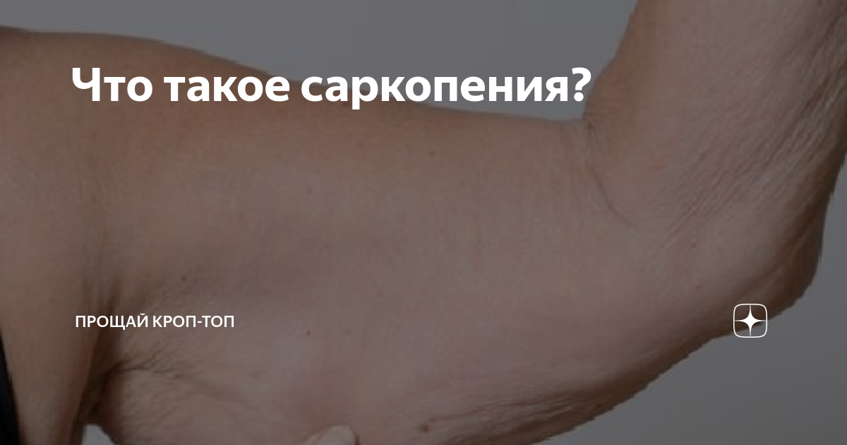 Что такое саркопения? | Прощай кроп-топ | Дзен