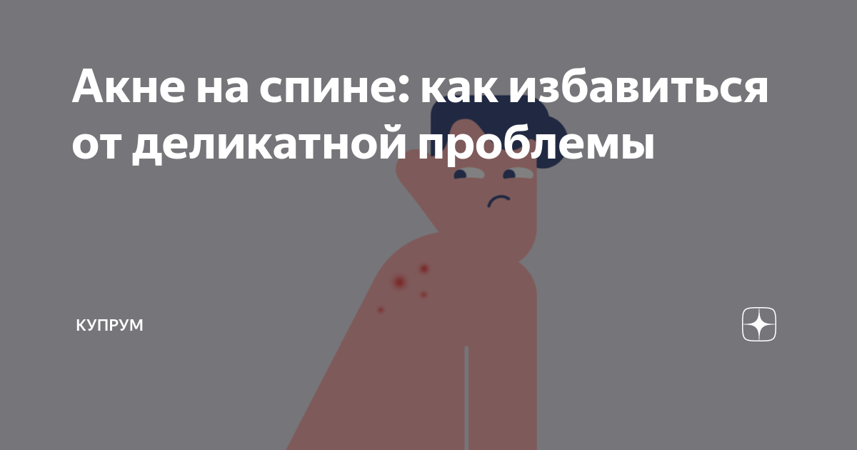 Акне на спине: как избавиться от деликатной проблемы | Купрум | Дзен