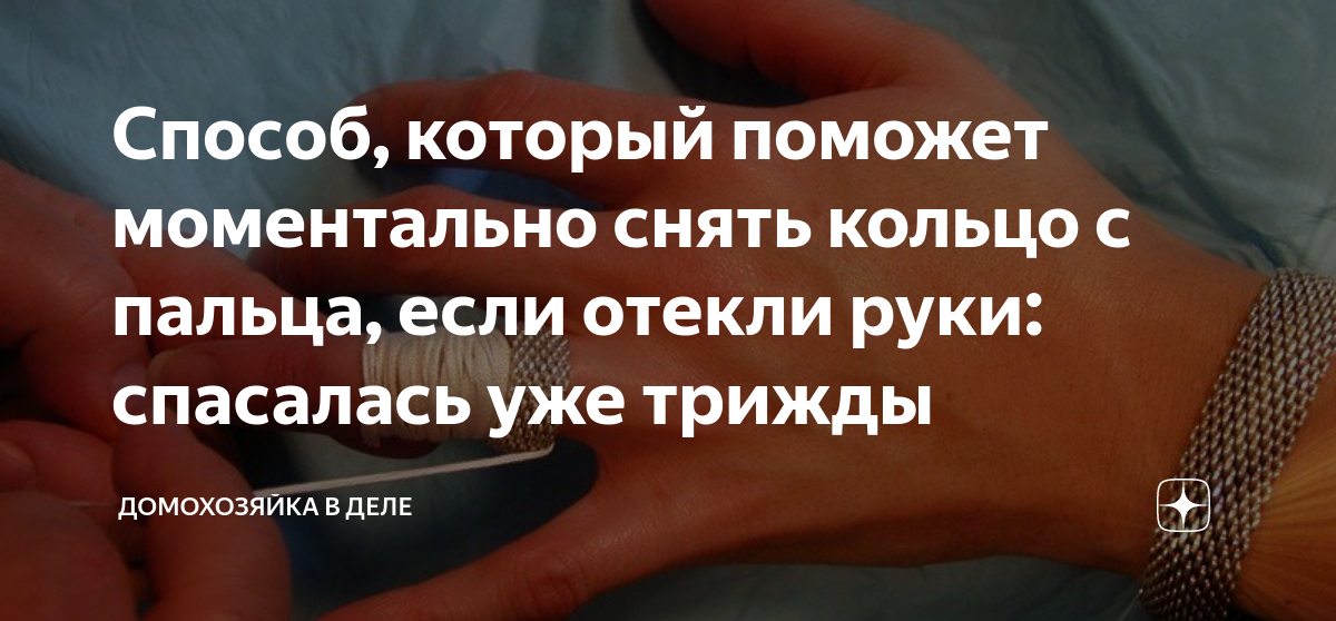 Как снять кольцо с отекшей руки Как снять кольцо с опухшего пальца в домашних условиях: советы
