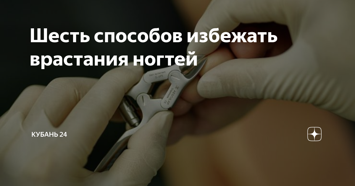 Шесть способов избежать врастания ногтей | Кубань 24. Полезное | Дзен