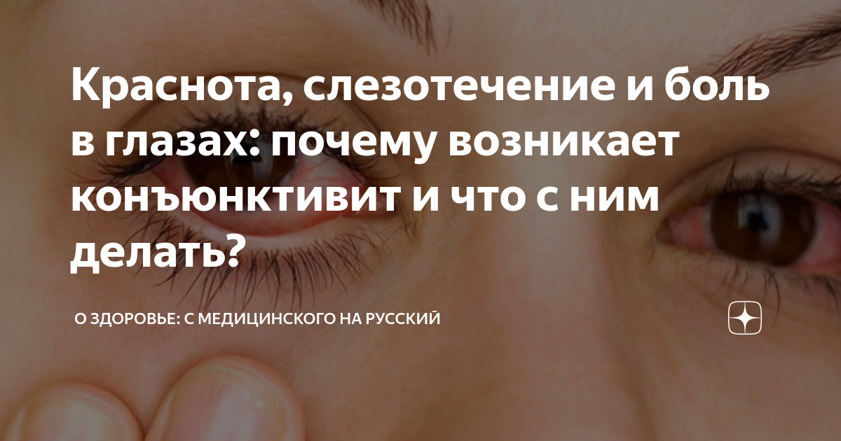 как снять красноту с глаз после слез