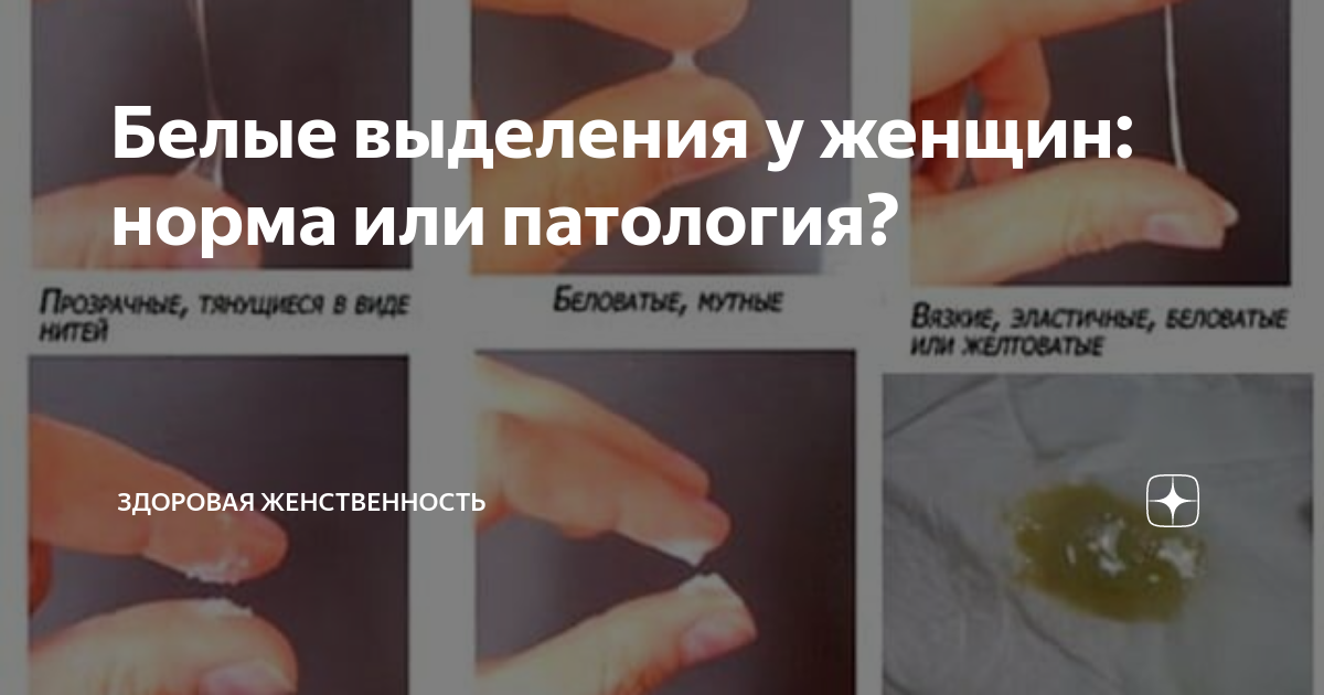 Белые выделения и запах у женщины. Женские выделения норма. вагинальные выделения норма.