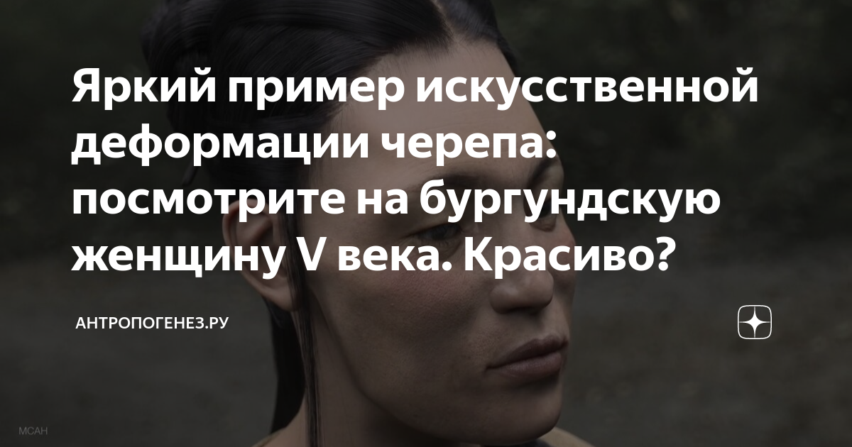 Яркий пример искусственной деформации черепа: посмотрите на бургундскую ...