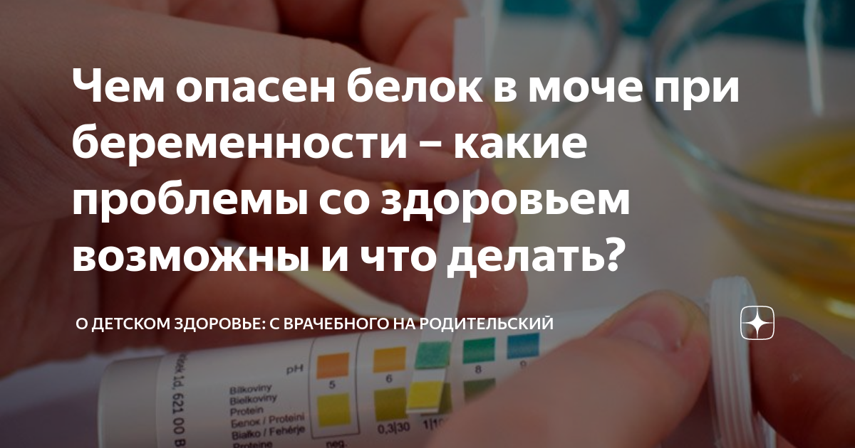 Что означает белок в моче у детей, узнать норму количества белка - KinderKlinik