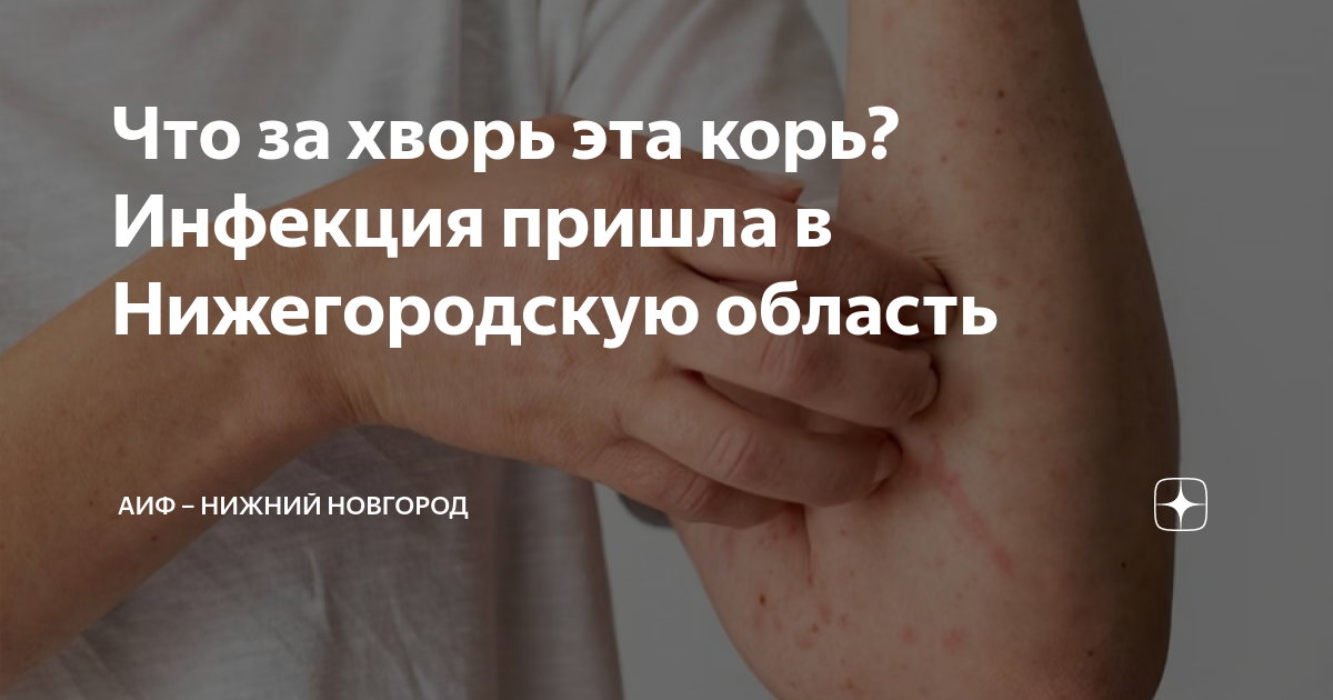 Что за хворь эта корь? Инфекция пришла в Нижегородскую область | АиФ ...