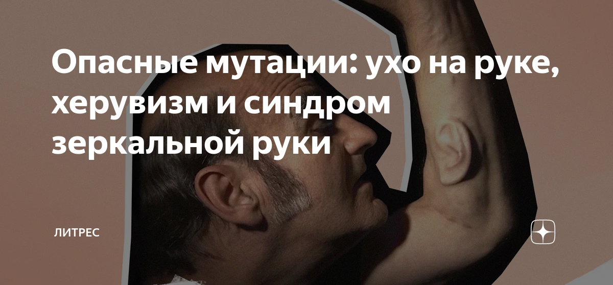 Опасные мутации: ухо на руке, херувизм и синдром зеркальной руки ...