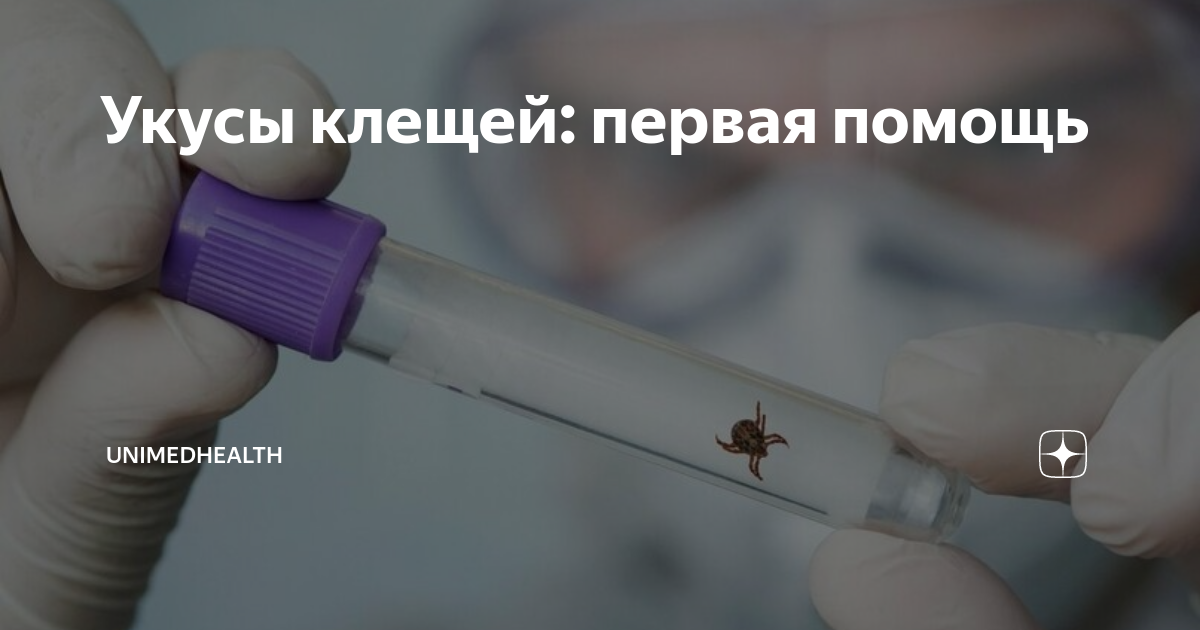 Укусы клещей: первая помощь | UnimedHealth | Дзен