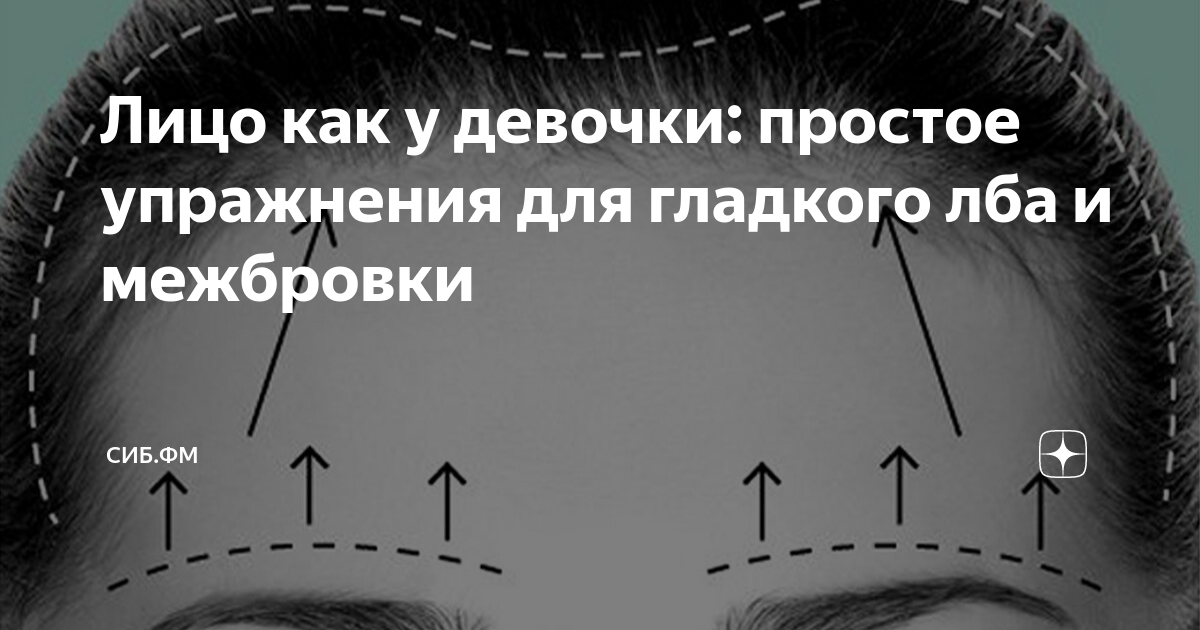 сколько единиц ботокса нужно для лба и межбровки