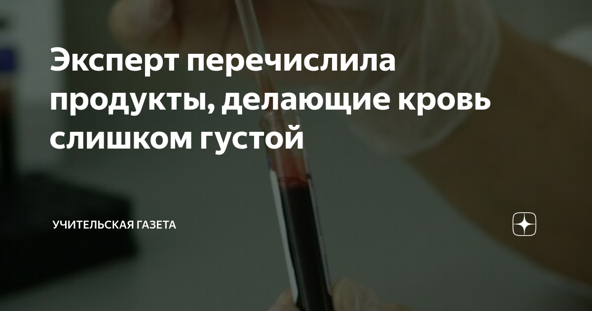Эксперт перечислила продукты, делающие кровь слишком густой ...