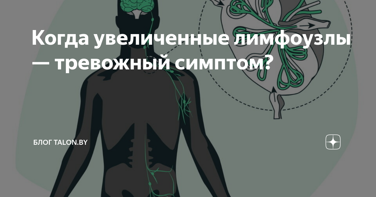 Когда увеличенные лимфоузлы — тревожный симптом? | Блог Talon.by | Дзен