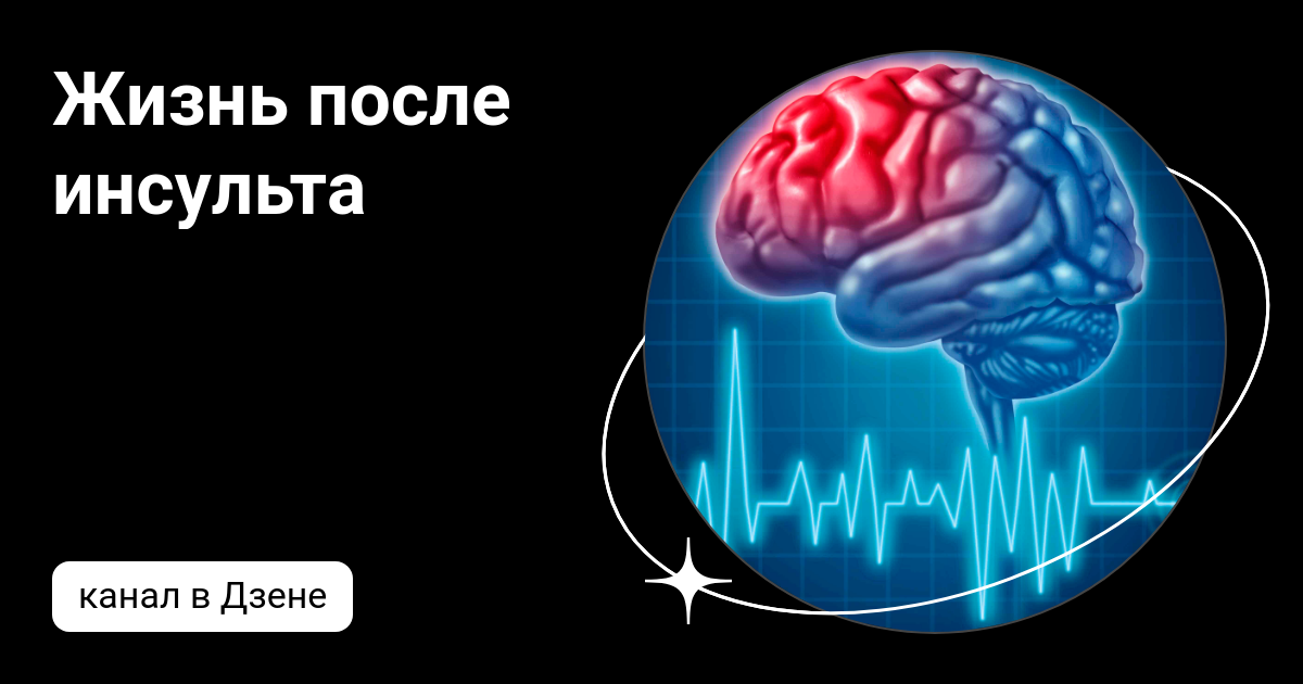 Роль реабилитационных мероприятий в возвращении пациента к полноценной жизни