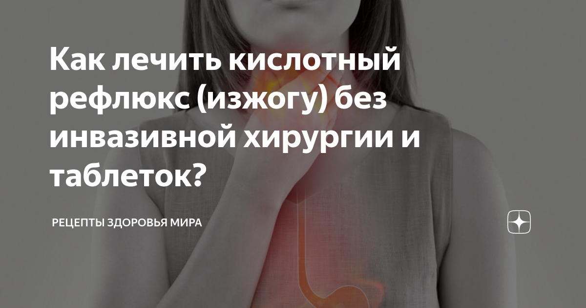 как сбить изжогу без таблеток