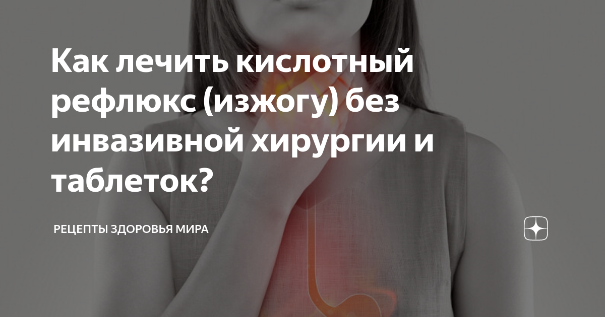 Что съесть от изжоги, если нет таблеток — список продуктов, помогающих при изжоге - Чемпионат