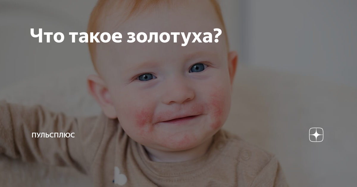 Что такое золотуха? Лечение болезни