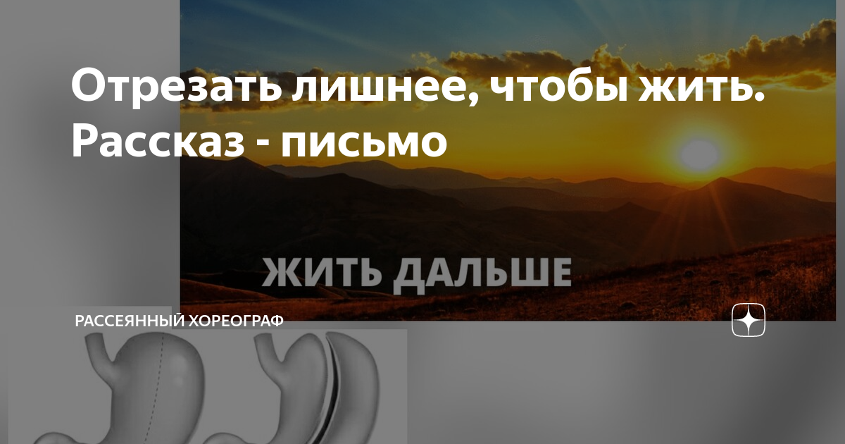 Рассеянный хореограф на дзене рассказы. Рассеянный хореограф. Отсекая лишнее