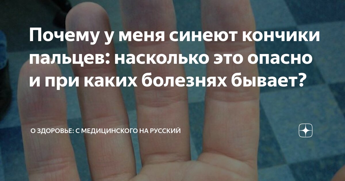 Синюшность кожи кистей рук – с какими болезнями связано, Лахта Клиника в СПб