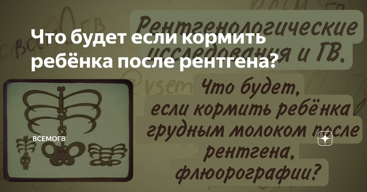 девочки, кто делал рентген при ГВ???