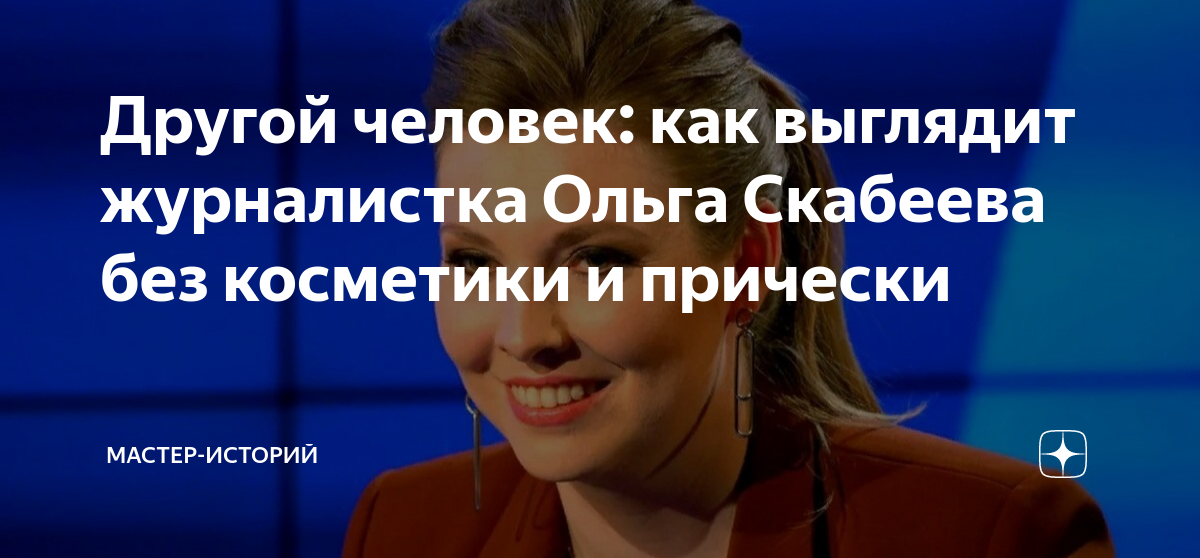 Мужские туфли, смешная челка, наивный взгляд: как выглядела Ольга Скабеева до популярности