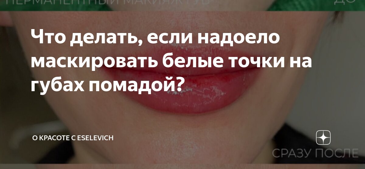 Белые точки на губах: что это, причины, как избавиться | РБК Life