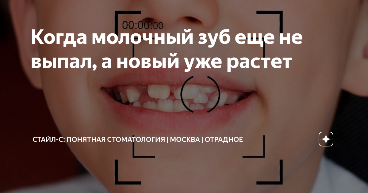 Может ли вырасти выпавший зуб. Может ли вырасти выпавший зуб