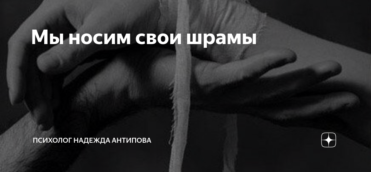 ты нуждаешься во мне. если человек любит. покажи мне свои шрамы сказал он но зачем спросила. я люблю все свои шрамы и хочу. я люблю все свои шрамы и хочу.