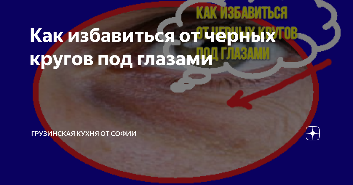 Как избавиться от черных кругов под глазами | Грузинская Кухня от Софии ...