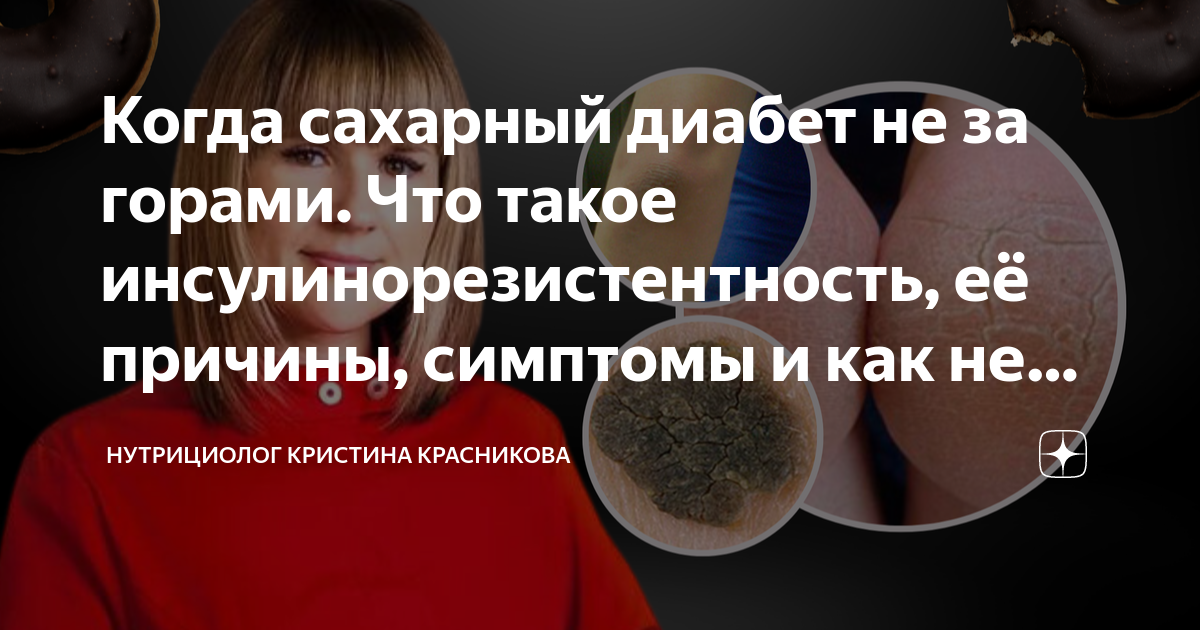 что такое диабетический криз