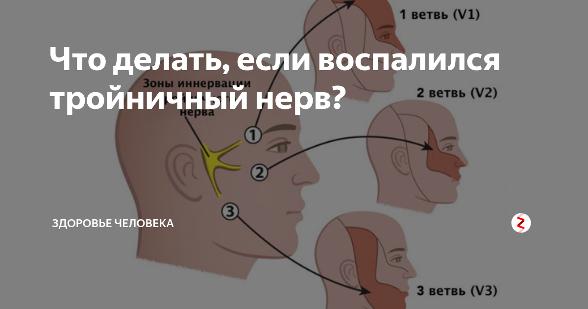 Троичный нерв где находится чем лечить. Воспаление тройничного нерва. Воспаление тройничного лицевого нерва симптомы. Воспаление тройничного нерва на лице. Тройничный нерв на лице симптомы.