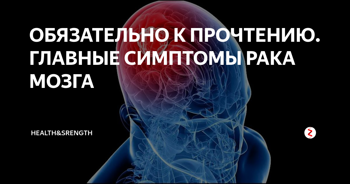 Опухоль головного мозга первый симптом. Признаки онкологии мозга. Признаки опухоли мозга. Опухоль головного мозга симптомы.