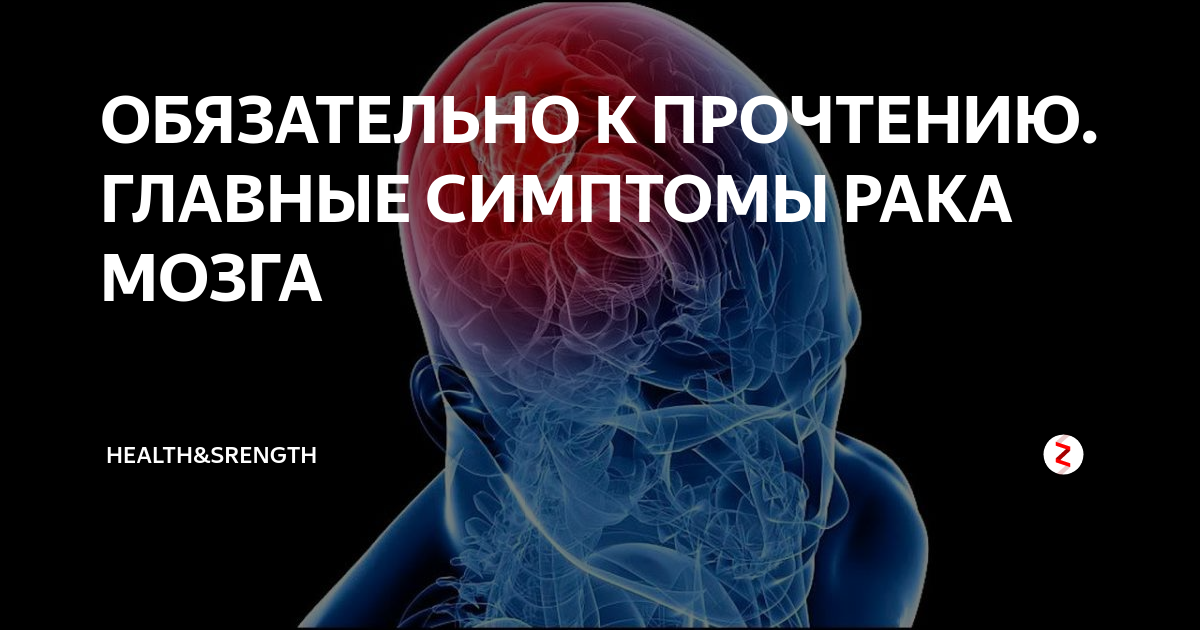 Симптомы онкологии головного мозга. Признаки онкологии мозга. Признаки опухоли мозга. Опухоль головного мозга симптомы.