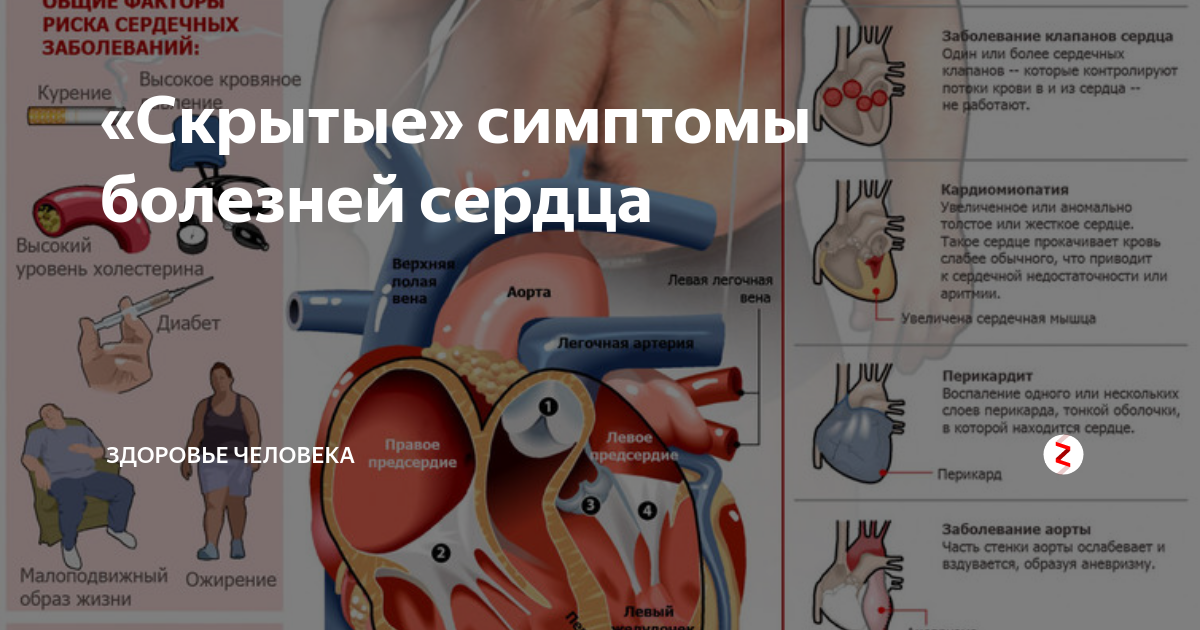 Симптомы проблем с сердцем. Признаки заболевания сердца. симптомы сердечных заболеваний. симптомы болезни сердца. заболевания сердца список.