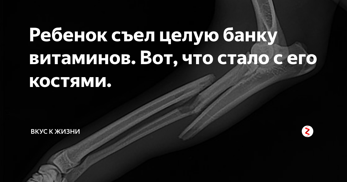 Съел витамины((