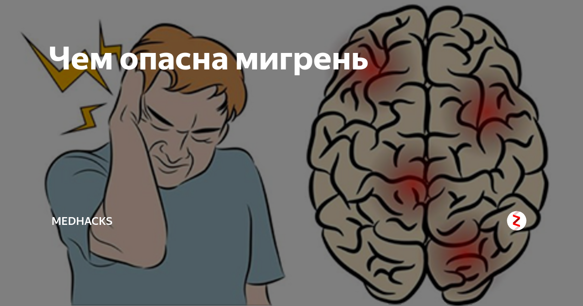 Что такое мигрень головы у женщин