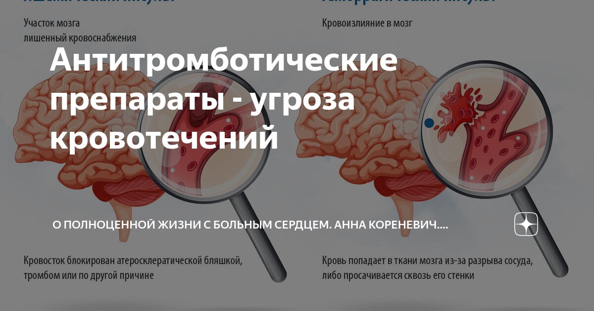 Антитромботические препараты - угроза кровотечений | Анна Кореневич ...