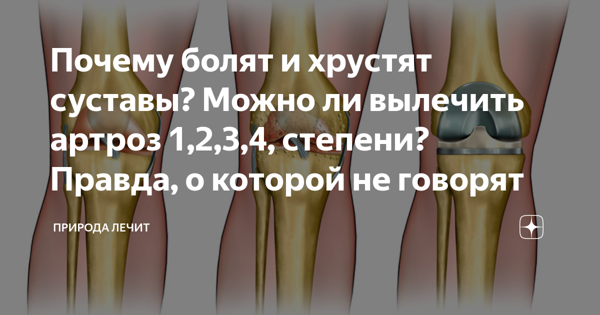 Почему болят и хрустят суставы? Можно ли вылечить артроз 1,2,3,4 ...