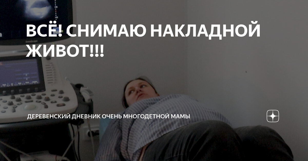 ВСЁ! СНИМАЮ НАКЛАДНОЙ ЖИВОТ!!! | ДЕРЕВЕНСКИЙ ДНЕВНИК ОЧЕНЬ МНОГОДЕТНОЙ ...