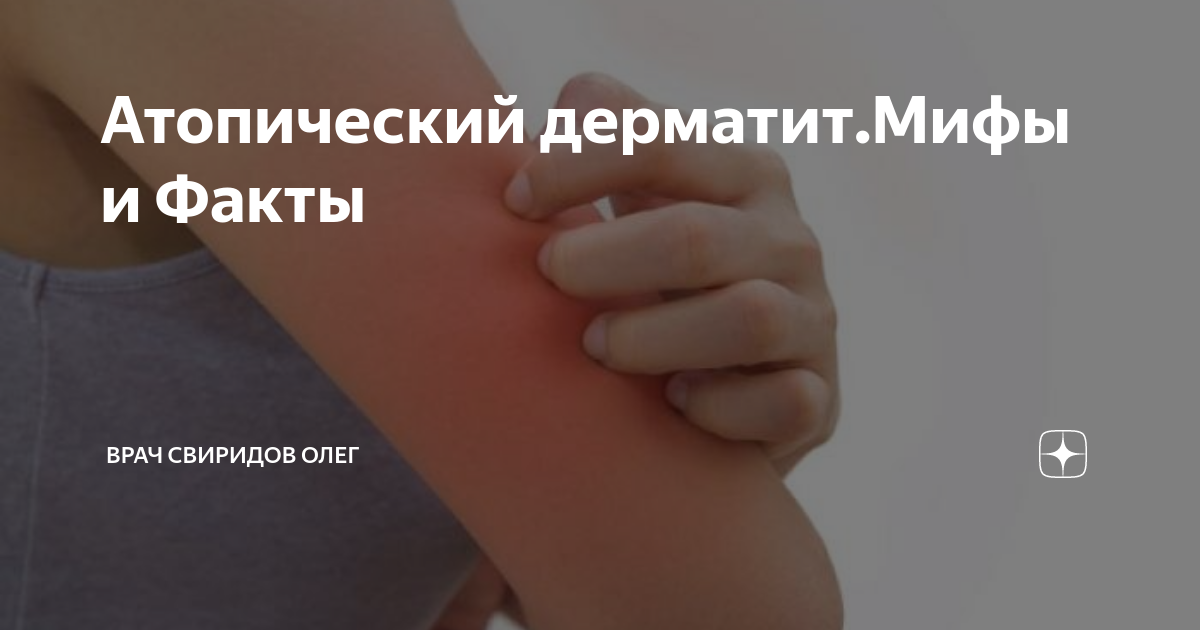 Атопический дерматит.Мифы и Факты | Врач Свиридов Олег | Дзен