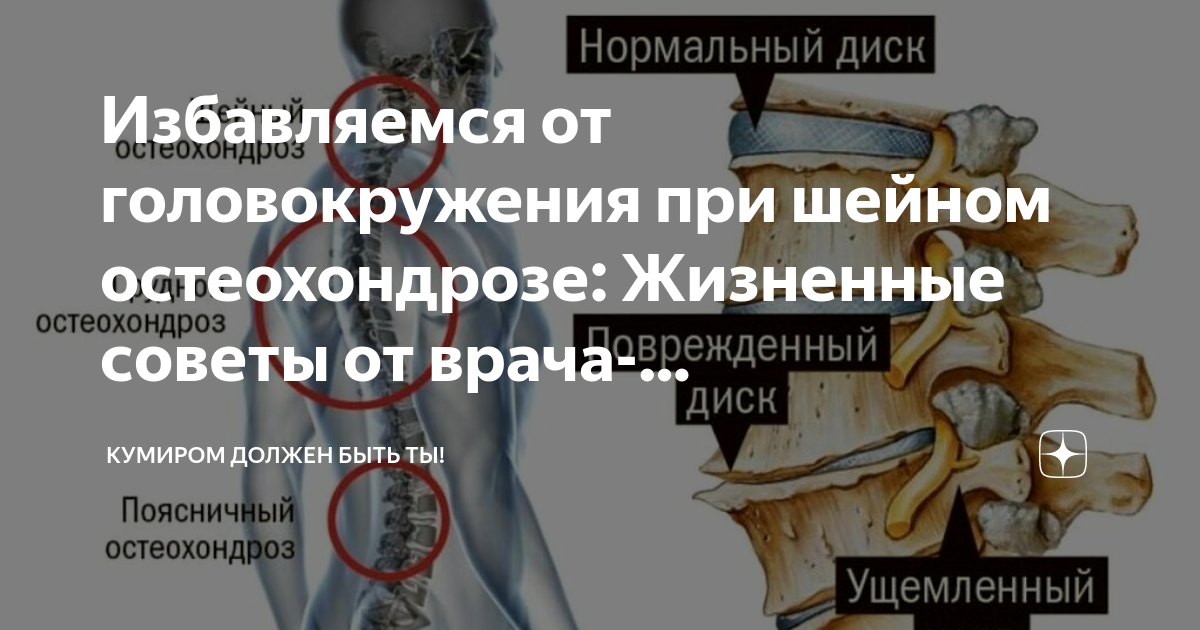 Остеохондроз шейного отдела головокружение лечение. Головокружение при шейном остеохондрозе. Как избавиться от остеохондроза навсегда. Шейный остеохондроз и головокружение страхи и депрессия. Упражнения от головокружения при шейном остеохондрозе.