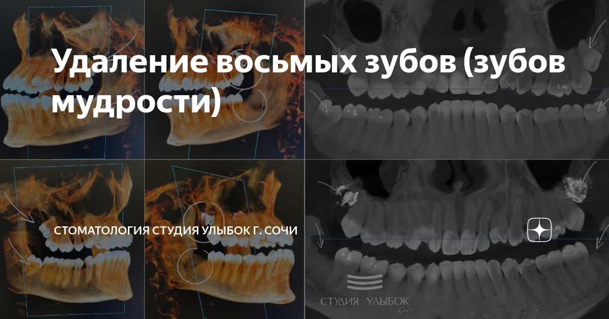 Удалить 8. Удалить 8