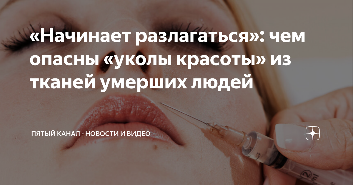 Чем опасны уколы гиалуроновой кислоты в сустав. Гиалуроновая кислота для суставов препараты отзывы уколы по цене от. Уколы в сустав больше НЕ РАБОТАЮТ! Вся правда о гиалуроновой кислоте Укол гиалуроновой кислоты в сустав коленный сустав. Гиалуроновая.