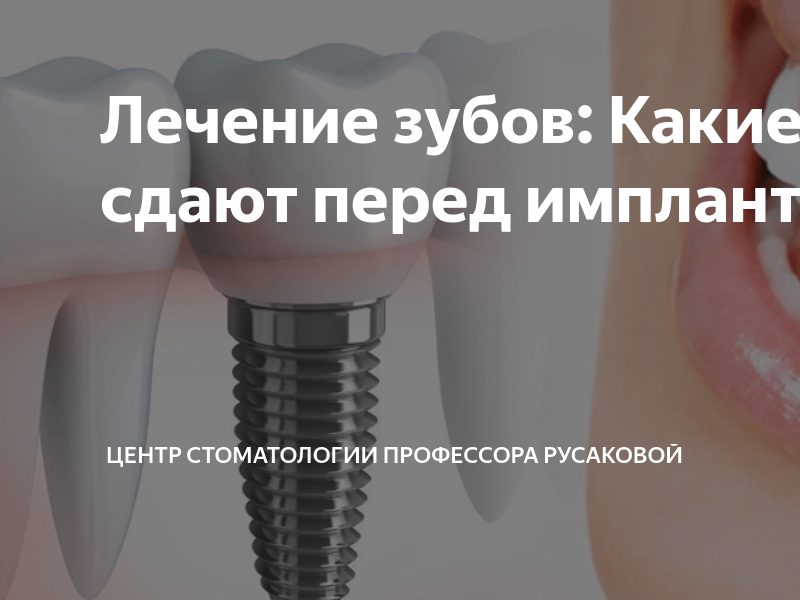 Лечение зубов: Какие анализы сдают перед имплантацией | Центр ...