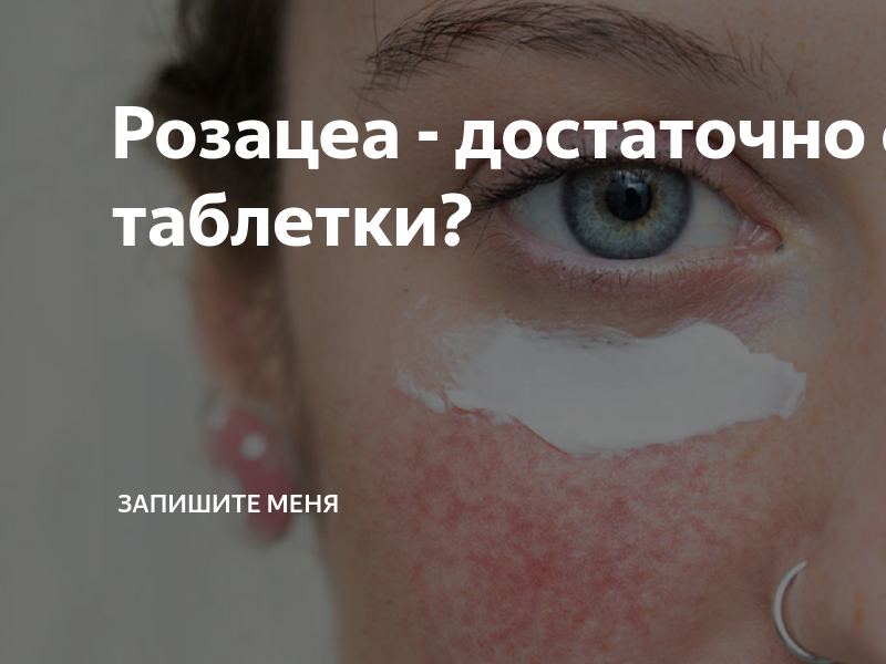 Розацеа - достаточно одной таблетки? | Запишите меня | Дзен