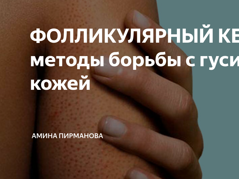 ФОЛЛИКУЛЯРНЫЙ КЕРАТОЗ: методы борьбы с гусиной кожей | Амина Пирманова ...