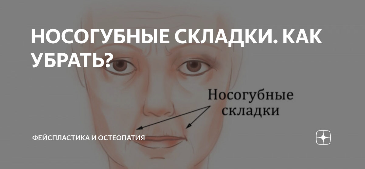 НОСОГУБНЫЕ СКЛАДКИ. КАК УБРАТЬ? | Международная Академия Фейспластики и ...