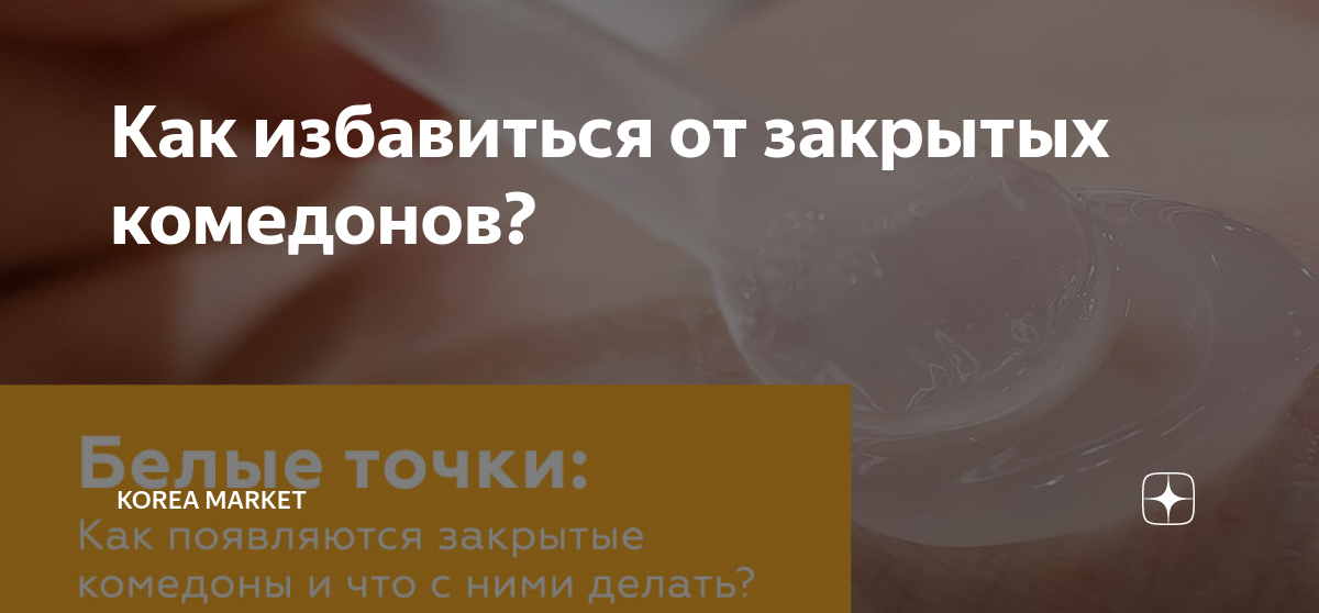 Как избавиться от закрытых комедонов? | Korea Market | Дзен
